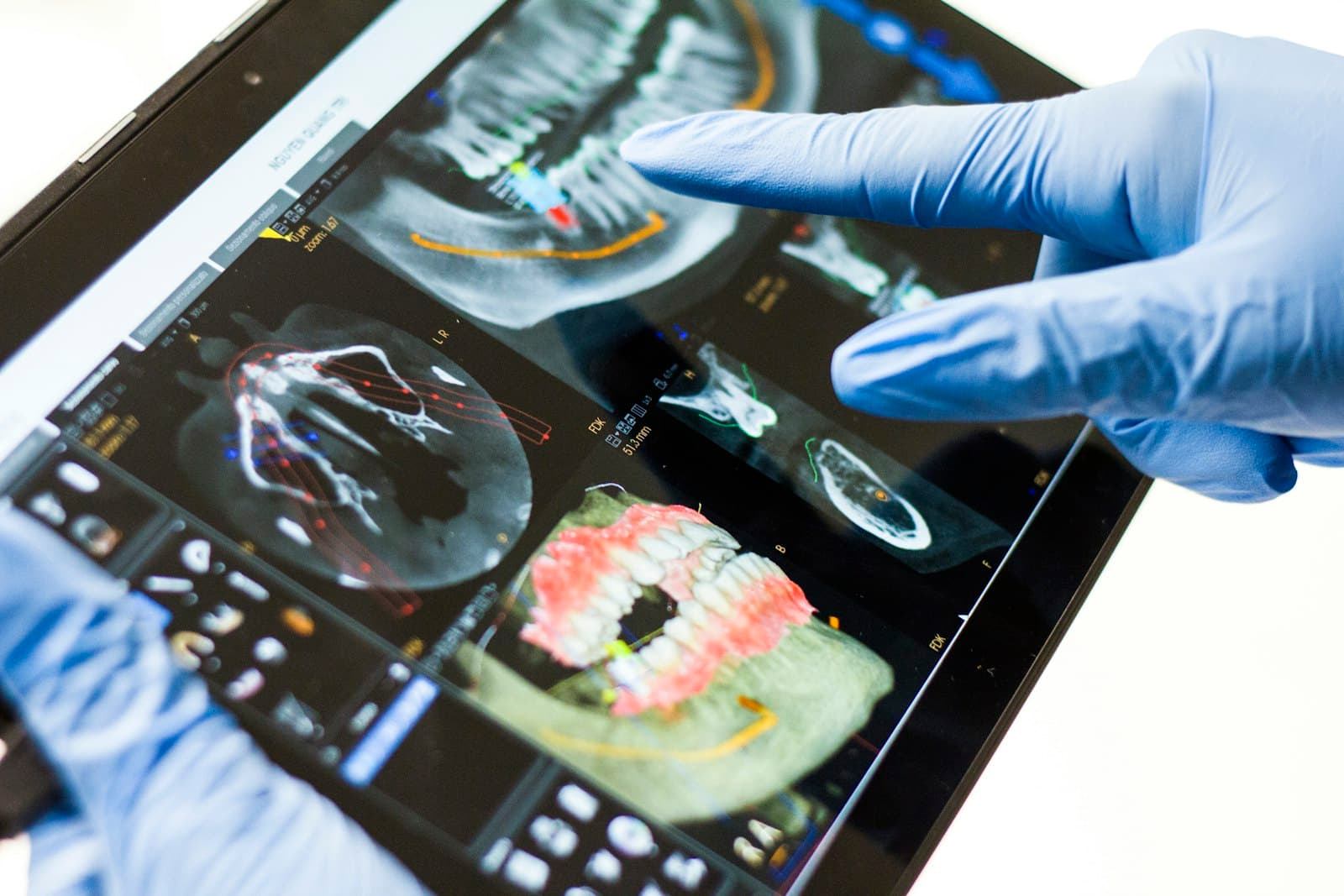 3D digital dental imaging reviewed on a tablet